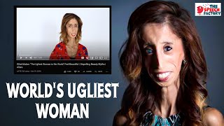 What Makes Worlds Ugliest Woman Feel Beautiful  Lizzie Velasquez  TEDx [upl. by Dlorah]