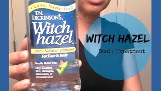 Scalp Treatment w WITCH HAZEL  Natural Hair [upl. by Maxine]