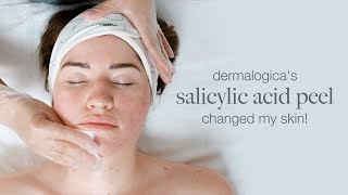 Dermalogica s Salicylic Acid peel changed my skin [upl. by Enylhsa]