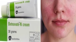 How To Use Betnovate Cream  Clear Face Redness  Get Rid Of Pigmantation By Sanam [upl. by Merat]