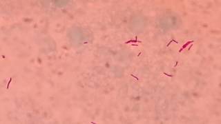 AFB stained slide of Mycobacterium tuberculosis like bacteria on counter stain Malachite green [upl. by Fortin798]