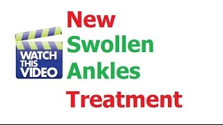 Best Swollen Ankles Treatment Stops Fluid Retention Edema and Puffy Ankles [upl. by Ger]