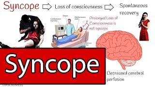 Syncope and Fainting Syncope Types and Treatment Simply explained [upl. by Dnalrag7]