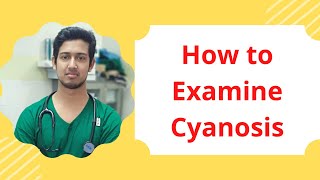 How to examine Cyanosis  Medicine  MBBS final prof exam [upl. by Adlig637]