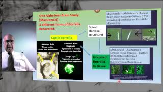 NonSpiral Borrelia Part 1 Explanation of Shape shifting and Form Metamorphosis of Spirochetes [upl. by Lemahs]