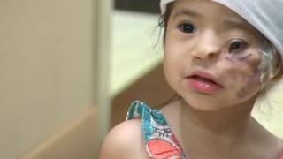 News 12 Toddler born with deformity gets lifechanging surgery on LI [upl. by Panter593]