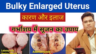 What is Bulky Enlarged Uterus  Cause Symptoms and Treatment  गर्भाशय में सूजन का इलाज [upl. by Geminian]