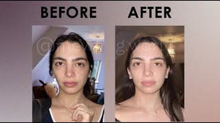 🔥 HOW TO FIX ASYMMETRICAL FACE NATURALLY 🔥🙂 [upl. by Nylekcaj]