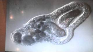 Amoeba eats two paramecia Amoebas lunch [upl. by Hekking225]