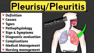 PleurisyPleuritis lecture in Hindi and English medical nursingcriteria pleuritis paramedical [upl. by Maritsa]