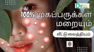 How To Remove Pimples From Face In Tamil  Get Rid Of Acne  How to Remove Pimple Easily [upl. by Avin]