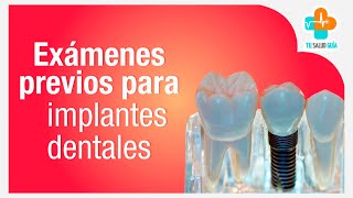 Exámenes previos para implantes dentales  Tu Salud Guía [upl. by Anikes727]