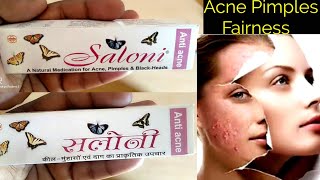 Saloni anti acne cream use or side effects in hindi [upl. by Enelrak]