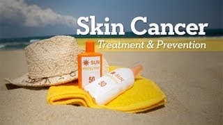 Skin Cancer Treatment and Prevention  Research on Aging [upl. by Ahseiyn183]