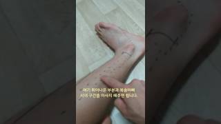 비골근 근막이완 Fibularis Longus Brevis SMR [upl. by Oinotnanauj]