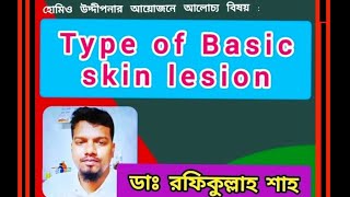 Type of Basic Skin Lesion  ত্বকের ক্ষতের বিকৃতির প্রাথমিক প্রকারভেদ  Dr Rafik Ullah Shah  HU [upl. by Marlin]