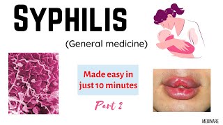 Syphilis Part  2  Made easy in 10 minutes  Medinare [upl. by Assela]