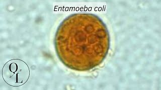 10 Entamoeba coli [upl. by Calypso55]