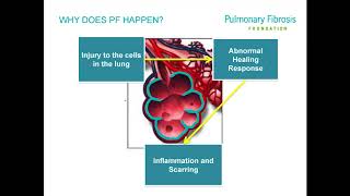 Hypersensitivity Pneumonitis Webinar [upl. by Nawoj64]