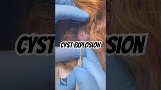 Cyst Explosion [upl. by Itteb]