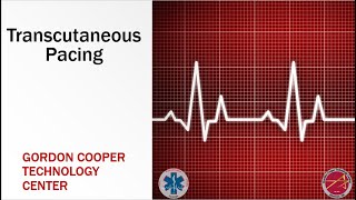 Paramedic Transcutaneous Pacing [upl. by Haodnanehs]