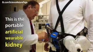 Wearable Artificial Kidney [upl. by Garibull]