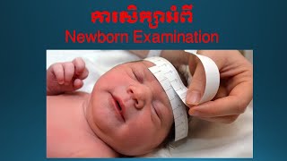 Newborn Examination [upl. by Rentschler571]