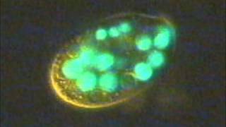 Ciliates eating fluorescent bacteria [upl. by Aciretahs]