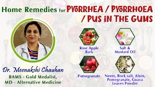 Home Remedies for Pyorrhea  Pyorrhoea  Pus in The Gums [upl. by Sawyor]