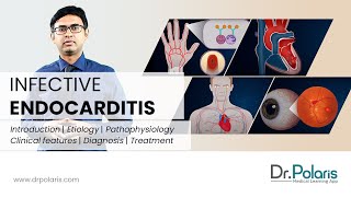 INFECTIVE ENDOCARDITIS  Etiology Pathophysiology Clinical Features Management  Animated [upl. by Moulden]