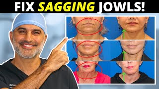 Sagging Jowls 101 How they form and what to do about them tighten and eliminate [upl. by Bein]