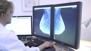 New method detects more breast cancer in screening [upl. by Ary]