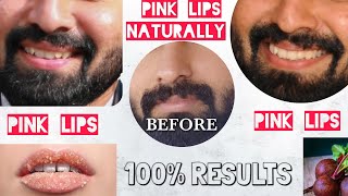 How to treat PIGMENTATION around the MOUTH  LIPS  Home Remedies Creams and Treatments हिंदी में [upl. by Farika552]