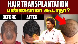 Hair Fall Solution  முடி கொட்டுதா இனி கவலைப்படாதீங்க  Best Treatment For Hair Fall  Health [upl. by Coster]