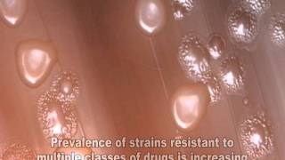 Streptococcus pneumoniae [upl. by Mina]