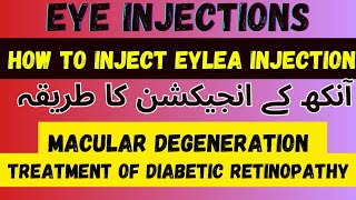 Intravitreal Eylea injection 💉  Intravitreal AntiVegf Injection  Dr Faisal Anwar [upl. by Zetnahs720]