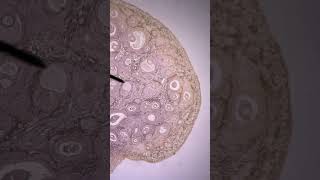 Development of Ovarian Follicle  Embryology Anatomy Animation  VLearning™  sqadiacom [upl. by Kcira726]