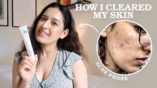 My 3 Step EvidenceBased Skincare Routine As A Doctor  HOW I CLEARED MY ACNE  Affordable Easy [upl. by Helprin]