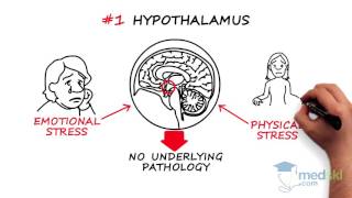 Obstetrics and Gynecology – Secondary Amenorrhea By Paul Davies MD [upl. by Lasala]