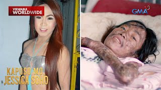 Dating konteserabaldado na sa higaan dahil sa kanyang misteryosong sakit  Kapuso Mo Jessica Soho [upl. by Sykleb]