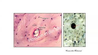 bone and alveolar process [upl. by Korenblat]