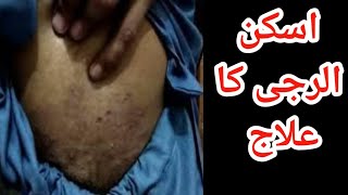 skin allergy fungal infection dermatitis allergy [upl. by Ahsikam255]