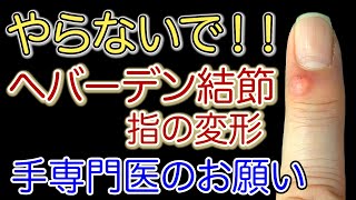 【手専門医解説】ヘバーデン結節でやってはいけない事 粘液嚢腫とは？ [upl. by Tallbott187]