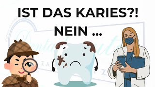 Ist das Karies Nein [upl. by Rahs]