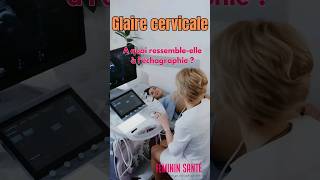 Glaire cervicale  à quoi ressemble telle à léchographie [upl. by Nylarahs]