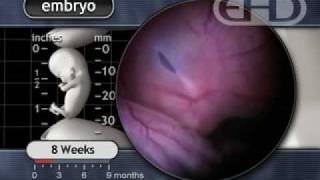 The Human Embryo Eight Weeks After Conception [upl. by Ireland]