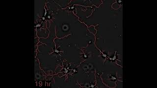 VideoOfTheDay SLIM imaging and analysis of neuronal network formation [upl. by Jere]