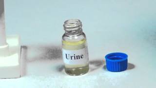 Detection of Bile Salt in Urine  MeitY OLabs [upl. by Michal]