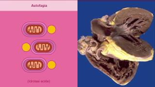 Atrofia metaplasia e displasia [upl. by Greenburg926]