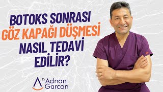 Botoks sonrası göz kapağı düşmesi nasıl tedavi edilir  Dr Adnan Gürcan [upl. by Rab]